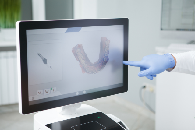 Svanner Intraoral
